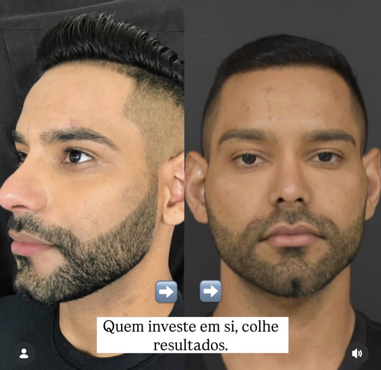 Resultado 03 • Antes da transformação 4
